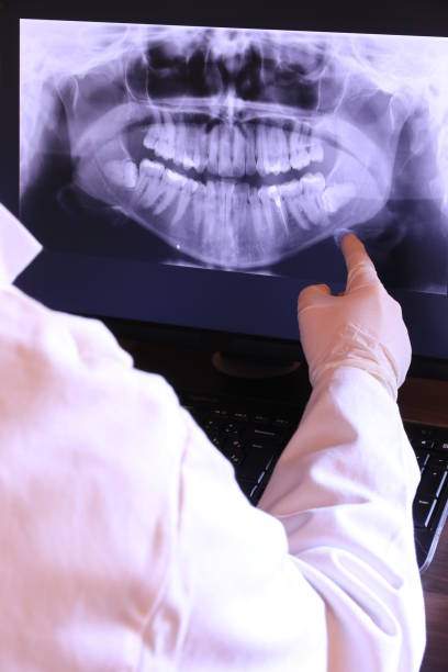 Best Knocked-Out Tooth Emergency  in Limestone Creek, FL