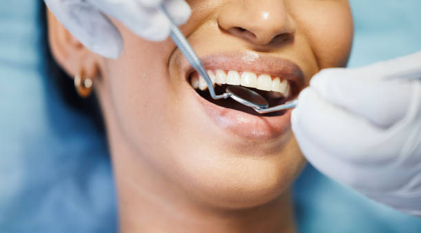Best Cracked Tooth Emergency Dentist  in Limestone Creek, FL